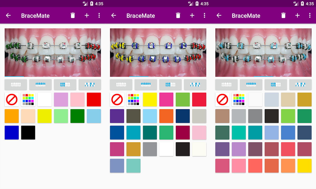 10 mejores apps para simular aparatos dentales | Top Apps para simular aparatos dentales