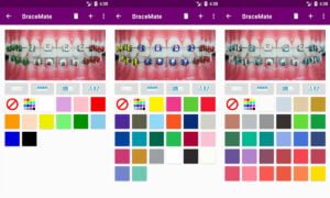 Aplicaciones para simular aparatos dentales | Aplicaciones para simular aparatos dentales Compruebelo y descarguelo gratis