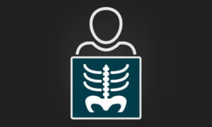 Las mejores aplicaciones de rayos X para descargar gratis | 11. Las mejores aplicaciones de rayos X para descargar gratis